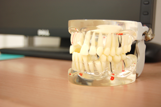 歯周病は成人の8割がかかってる病気です。歯周病は日本人が歯を失う1番の原因です